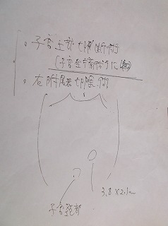 イラスト 子宮と卵巣の説明のみでした