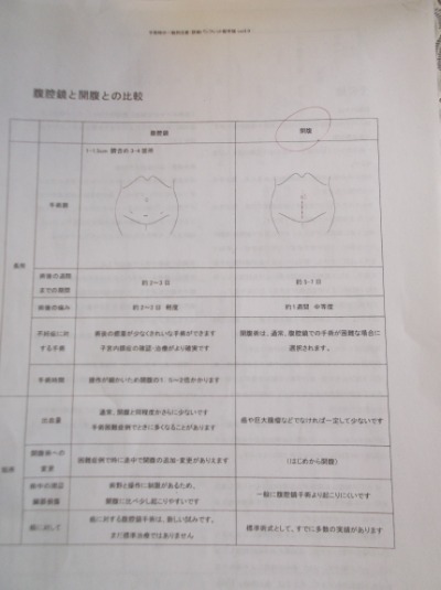 子宮筋腫開腹手術の臍上からの手術痕のイラストと腹腔鏡手術のイラスト。両方とも説明はありませんでした。