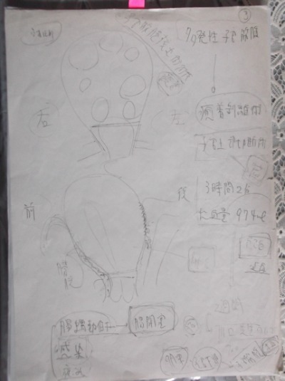 卵巣は元に戻っているのイラスト